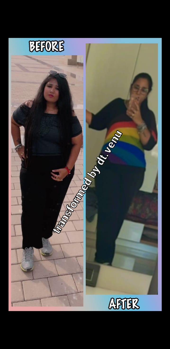 Dietician Venu Aggarwal Das